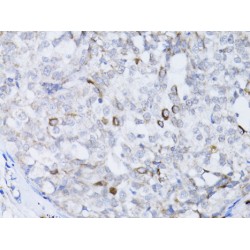 Breast Cancer Type 1 Susceptibility Protein (BRCA1) Antibody