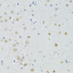 Breast Cancer Type 1 Susceptibility Protein (BRCA1) Antibody