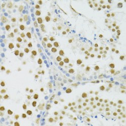 Breast Cancer Type 1 Susceptibility Protein (BRCA1) Antibody