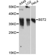 Western blot analysis of extracts of various cell lines, using BST2 antibody (abx125580) at 1:3000 dilution.