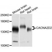Western blot analysis of extracts of various cell lines, using CACNA2D2 antibody (abx125591) at 1/1000 dilution.