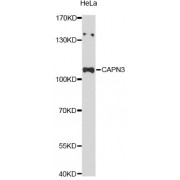 Western blot analysis of extracts of HeLa cells, using CAPN3 Antibody (abx125602) at 1:3000 dilution.