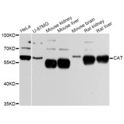 Western blot analysis of extracts of various cell lines, using CAT Antibody (abx125619) at 1:3000 dilution.