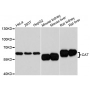 Western blot analysis of extracts of various cell lines, using CAT antibody (abx125620) at 1:3000 dilution.