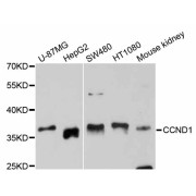 Western blot analysis of extracts of various cell lines, using CCND1 antibody (abx125624) at 1/1000 dilution.