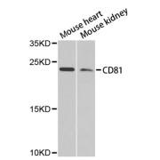 Western blot analysis of extracts of various cell lines, using CD81 antibody (abx125637) at 1/1000 dilution.