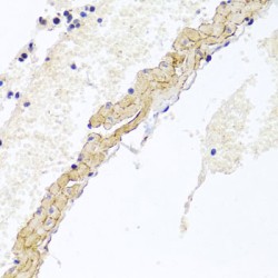 Cluster of Differentiation 81 (CD81) Antibody