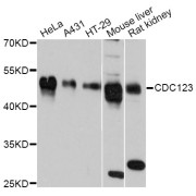 Western blot analysis of extracts of various cell lines, using CDC123 Antibody (abx125639) at 1:3000 dilution.