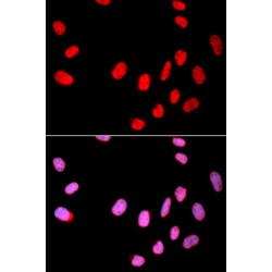 Cell Division Cycle 25C (CDC25C) Antibody