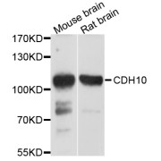 Western blot analysis of extracts of various cell lines, using CDH10 antibody (abx125646) at 1/1000 dilution.