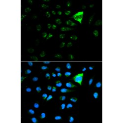 Cyclin Dependent Kinase Inhibitor 1A (CDKN1A) Antibody