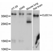 Western blot analysis of extracts of various cell lines, using CLEC1A antibody (abx125683) at 1/1000 dilution.