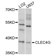 Western blot analysis of extracts of various cell lines, using CLEC4G antibody (abx125687) at 1/1000 dilution.