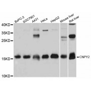 Western blot analysis of extracts of various cell lines, using CNPY2 antibody (abx125690) at 1/1000 dilution.