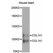 Western blot analysis of extracts of mouse heart, using COL1A1 antibody (abx125696) at 1/1000 dilution.