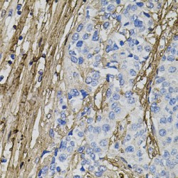 Collagen Type I Alpha 1 (COL1A1) Antibody