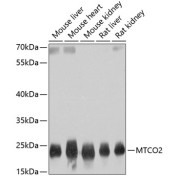 Western blot analysis of extracts of various cell lines, using MT-CO2 antibody (1/800 dilution).