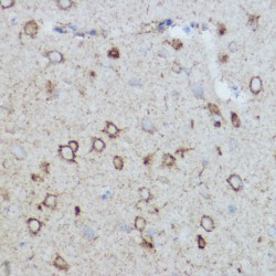 Cytochrome C Oxidase Subunit 2 / COX2 (MT-CO2) Antibody