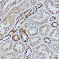 Cytochrome C Oxidase Subunit 2 / COX2 (MT-CO2) Antibody