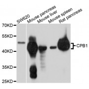Western blot analysis of extracts of various cell lines, using CPB1 antibody (abx125707) at 1/1000 dilution.