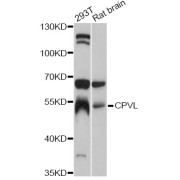 Western blot analysis of extracts of various cell lines, using CPVL antibody (abx125714) at 1:3000 dilution.