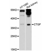 Western blot analysis of extracts of various cell lines, using CTGF antibody (abx125726) at 1/1000 dilution.