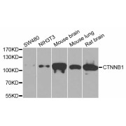 Western blot analysis of extracts of various cell lines, using CTNNB1 antibody (abx125732) at 1/1000 dilution.