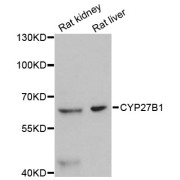 Western blot analysis of extracts of various cell lines, using CYP27B1 antibody (abx125742) at 1:3000 dilution.