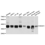 Western blot analysis of extracts of various cell lines, using DDAH1 antibody (abx125747) at 1/1000 dilution.