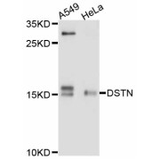 Western blot analysis of extracts of various cell lines, using DSTN antibody (abx125787) at 1:3000 dilution.