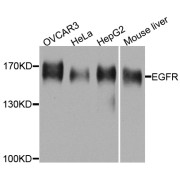 Western blot analysis of extracts of various cell lines, using EGFR antibody (abx125797) at 1/1000 dilution.