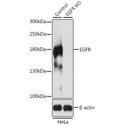 Epidermal Growth Factor Receptor (EGFR) Antibody