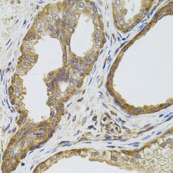 Epidermal Growth Factor Receptor (EGFR) Antibody