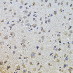 Epidermal Growth Factor Receptor (EGFR) Antibody