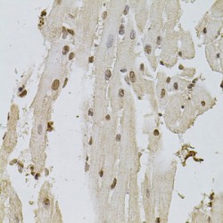 Epidermal Growth Factor Receptor (EGFR) Antibody