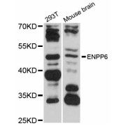 Western blot analysis of extracts of various cell lines, using ENPP6 antibody (abx125816) at 1/1000 dilution.