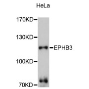 Western blot analysis of extracts of HeLa cells, using EPHB3 antibody (abx125820) at 1:3000 dilution.