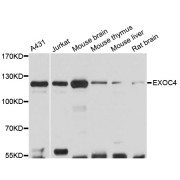 Western blot analysis of extracts of various cell lines, using EXOC4 antibody (abx125828) at 1:3000 dilution.