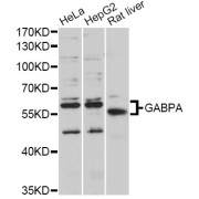 Western blot analysis of extracts of various cell lines, using GABPA antibody (abx125863) at 1/1000 dilution.