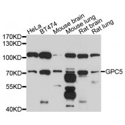 Western blot analysis of extracts of various cell lines, using GPC5 antibody (abx125894) at 1/1000 dilution.
