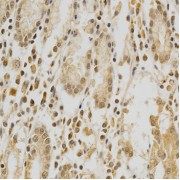 Immunohistochemistry of paraffin-embedded human stomach using HDAC6 antibody (abx125935) at dilution of 1/100 (40x lens).