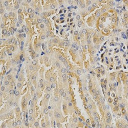 Histone Deacetylase 6 (HDAC6) Antibody