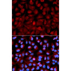 Histone Deacetylase 6 (HDAC6) Antibody