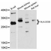 Western blot analysis of extracts of various cell lines, using HLA-DOB antibody (abx125944) at 1:3000 dilution.