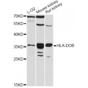 Western blot analysis of extracts of various cell lines, using HLA-DOB antibody (abx125945) at 1:3000 dilution.