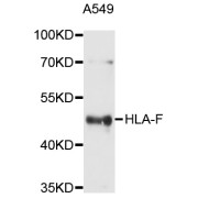 Western blot analysis of extracts of A-549 cells, using HLA-F antibody (abx125951) at 1/1000 dilution.