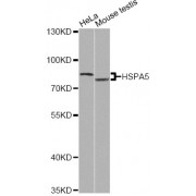 Western blot analysis of extracts of various cell lines, using HSPA5 antibody (abx125972) at 1/500 dilution.