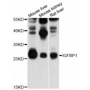 Western blot analysis of extracts of various cell lines, using IGFBP1 antibody (abx125986) at 1/1000 dilution.