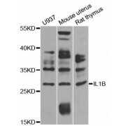 Western blot analysis of extracts of various cell lines, using IL1B antibody (abx125995) at 1/1000 dilution.