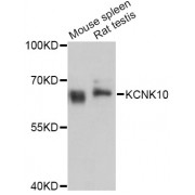 Western blot analysis of extracts of various cell lines, using KCNK10 Antibody (abx126037) at 1:3000 dilution.
